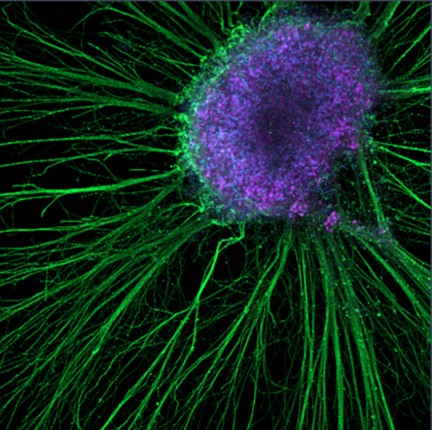 picture showing iPSC derived sensory neuron