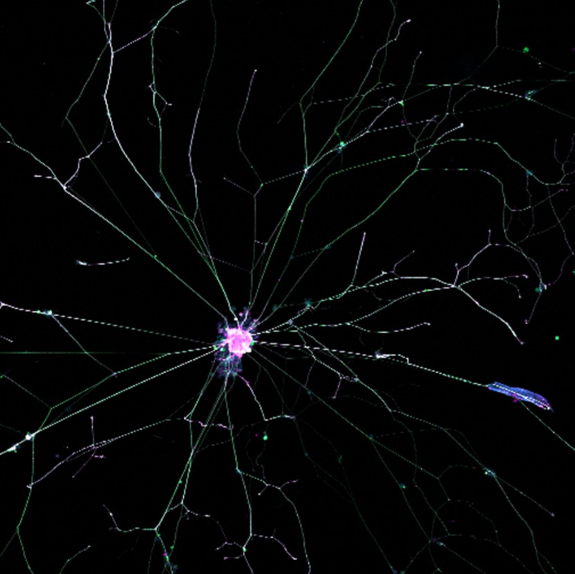 picture showing iPSC derived sensory neuron